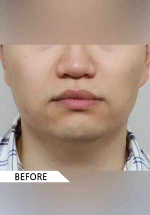 Before