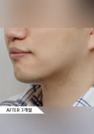 After