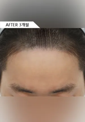 After