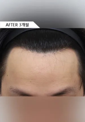 After