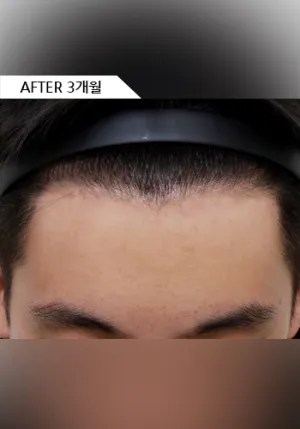 After