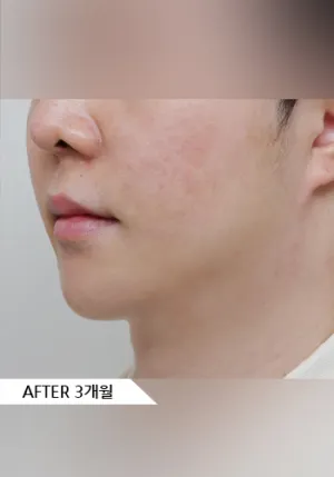 After