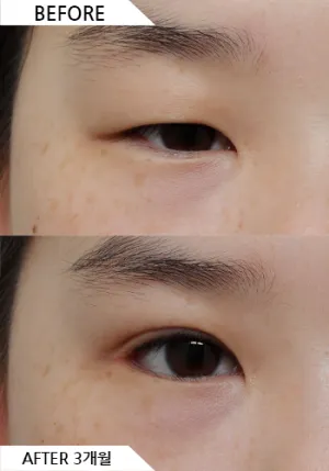 Before