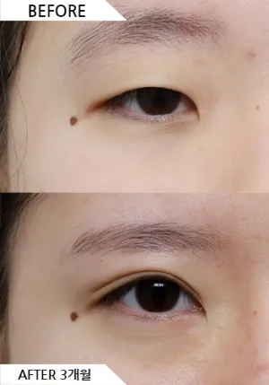 Before