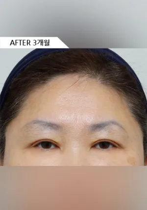 After