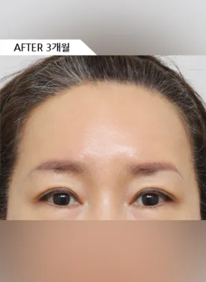 After