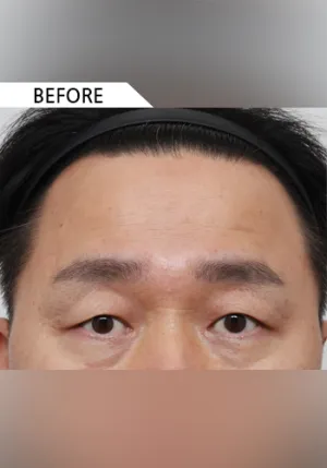 Before