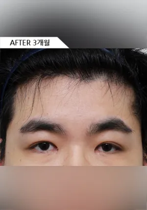 After