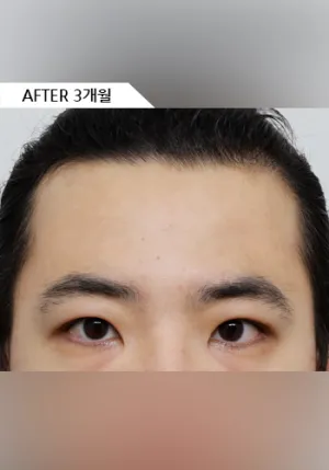 After