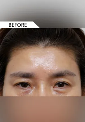 Before