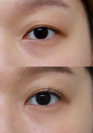 After