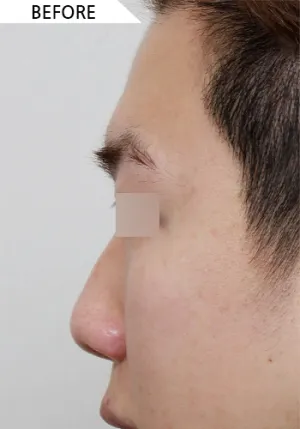 Before