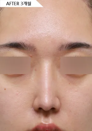 After