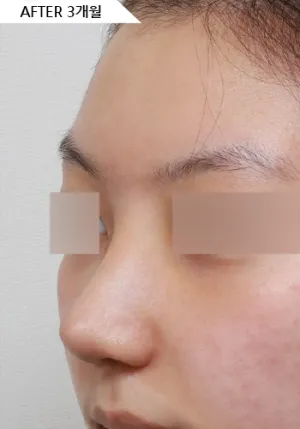 After