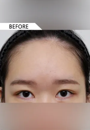 Before