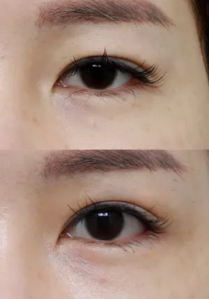 After