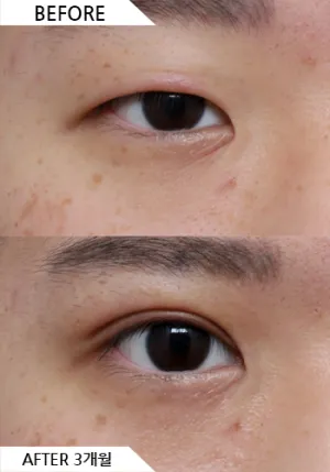 Before