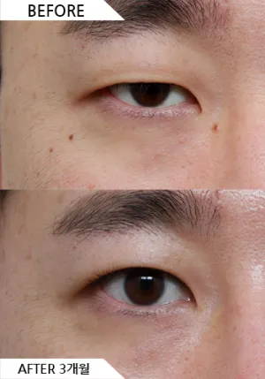 Before