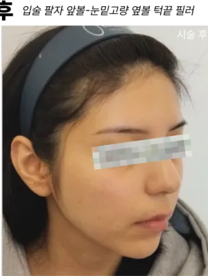 After