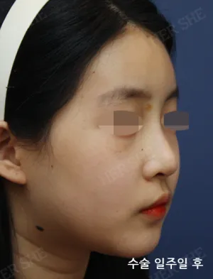 After