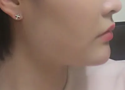 Tạm biệt nọng cằm ㅋㅋ Venus tốt đó