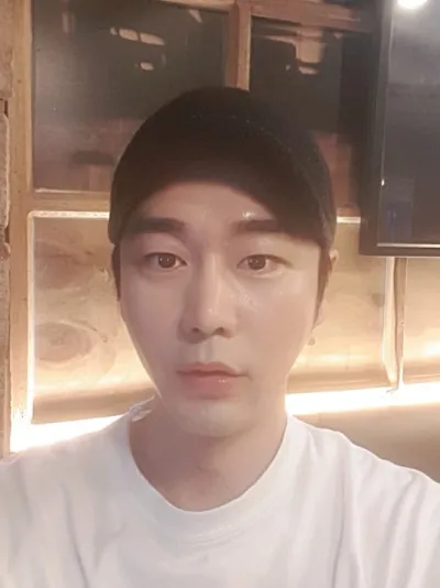 Mình đã thực hiện căng chỉ và cấy mỡ trán ~