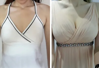 Đánh giá nâng ngực ạ ~