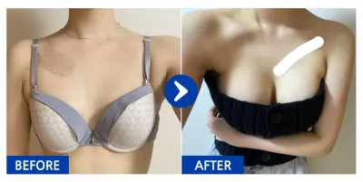 [Babytalk] Phẫu thuật nâng ngực / Tháng thứ 6 / Biệt danh: Mel-ryong