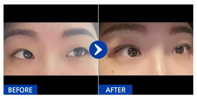 [Gangnam Unni] Nhấn mí tự nhiên / Ngày 3 / Biệt danh: CassieYu