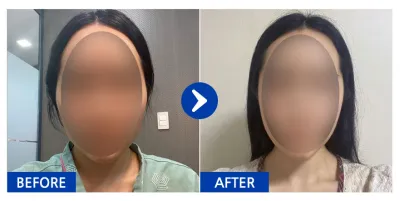 [Babitalk] Phẫu thuật đường nét khuôn mặt / 1 tháng / Biệt danh: Yum Daeding