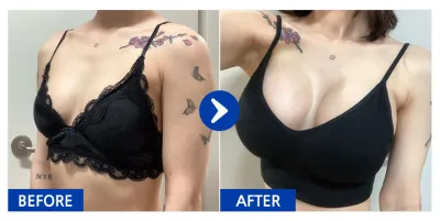 [Babytalk] Ngực (Motiva) / Tuần 2 / Biệt danh: Ba anh em gấu