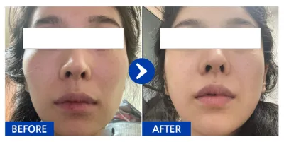 [Gangnam Unni] Gò má / 1 tháng / Biệt danh: Meaningmade