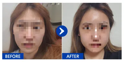 [Babitalk] Gò má, hàm vuông / Tuần 3 / Biệt danh: 223345