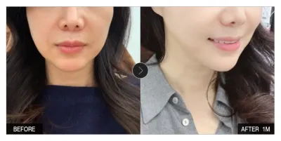 [Review Gangnam Unni] Căng chỉ tháng thứ 1 / Biệt danh: sooeu_