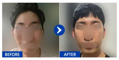 [Gangnam Unni] Gò má tháng thứ 1 / Nickname: firnrb_b