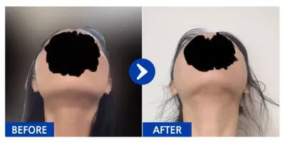 [Gangnam Unni] Gò má tháng thứ 1 / Biệt danh: 하하하하하하하마