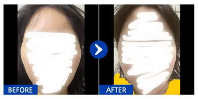 [Gangnam Unni] Gò má tháng thứ 1 / Biệt danh: qweasdfgh