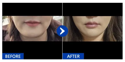 [Gangnam Unni] Căng chỉ tháng thứ 1 / Biệt danh: Lee Mi-seon.