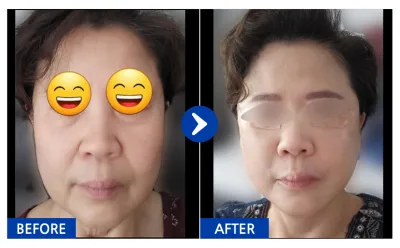 [Gangnam Unni] Căng chỉ tháng thứ 1 / Biệt danh: Thỏ kỳ quặc