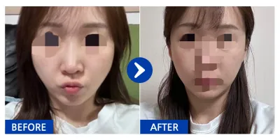 [Gangnam Unni] Gò má / Tháng thứ 1 / Biệt danh: Jjinie