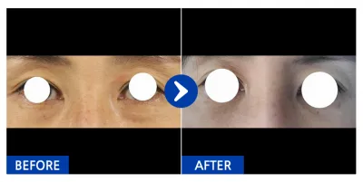 [Gangnam Unni] Tái định vị mỡ mắt / Tháng thứ 1 / Biệt danh: Đùi của Cha Du-ri