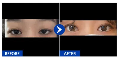 [Babytalk] Nhấn mí tự nhiên / Tuần 2 / Biệt danh: Teuni và những người bạn