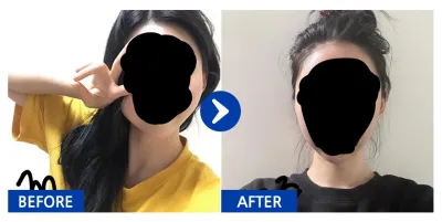 [Gangnam Unni] Gò má, hàm vuông tháng thứ 1 / Biệt danh: Arorararararang