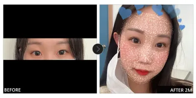 [Review Gangnam Unni] Phẫu thuật mắt sau một tháng / Biệt danh: 꽃신신자