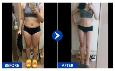 [Gangnam Unni] Hút mỡ toàn thân / Tháng thứ 3 / Biệt danh: Somsatang Mogu