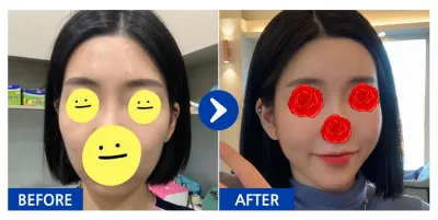 [Gangnam Unni] Cấy mỡ / Biệt danh: Tae-hi-hi-hi-hhh