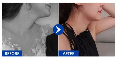 [Babytalk] Hút mỡ / Tháng thứ 2 / Biệt danh: Dani-jju-jju