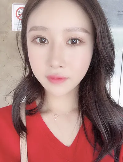 [Mắt] JW Plastic Surgery - Mắt, Mũi