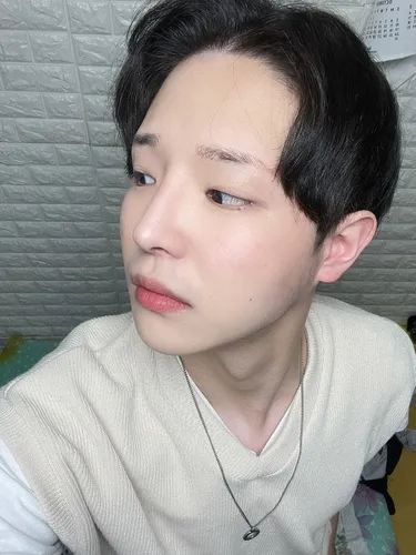 [Nam] Hyukss - Chỉnh sửa mắt hai mí (cắt mí), mở góc mắt trong, nâng mũi