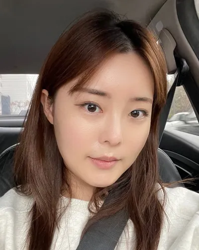 [Mắt] Chococho - Cắt mí mắt hai mí (Tái phẫu thuật)